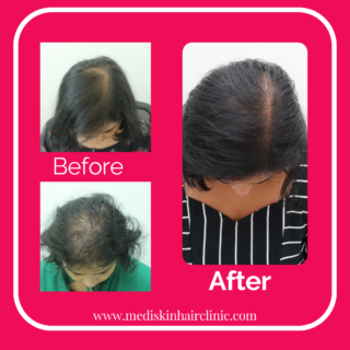 Before-10-Copy-320x320