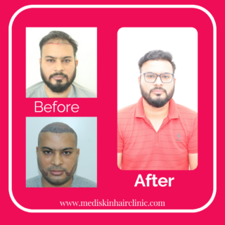 Before-7-Copy-320x320